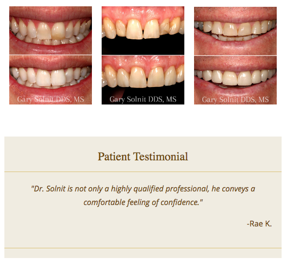 Dental websites with before and after gallery